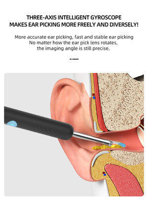 Smart Ear Cleaning Kit Camera (2 Colors) Ear Wax Removal LED Otoscope